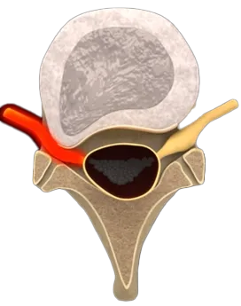 Chiropractic Mt Laurel Township NJ Spine